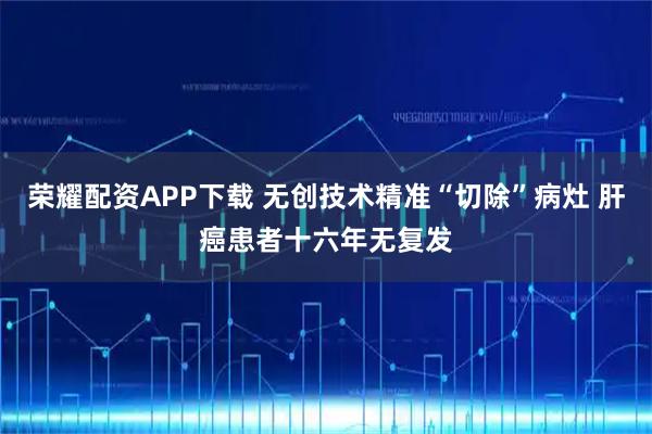 荣耀配资APP下载 无创技术精准“切除”病灶 肝癌患者十六年无复发
